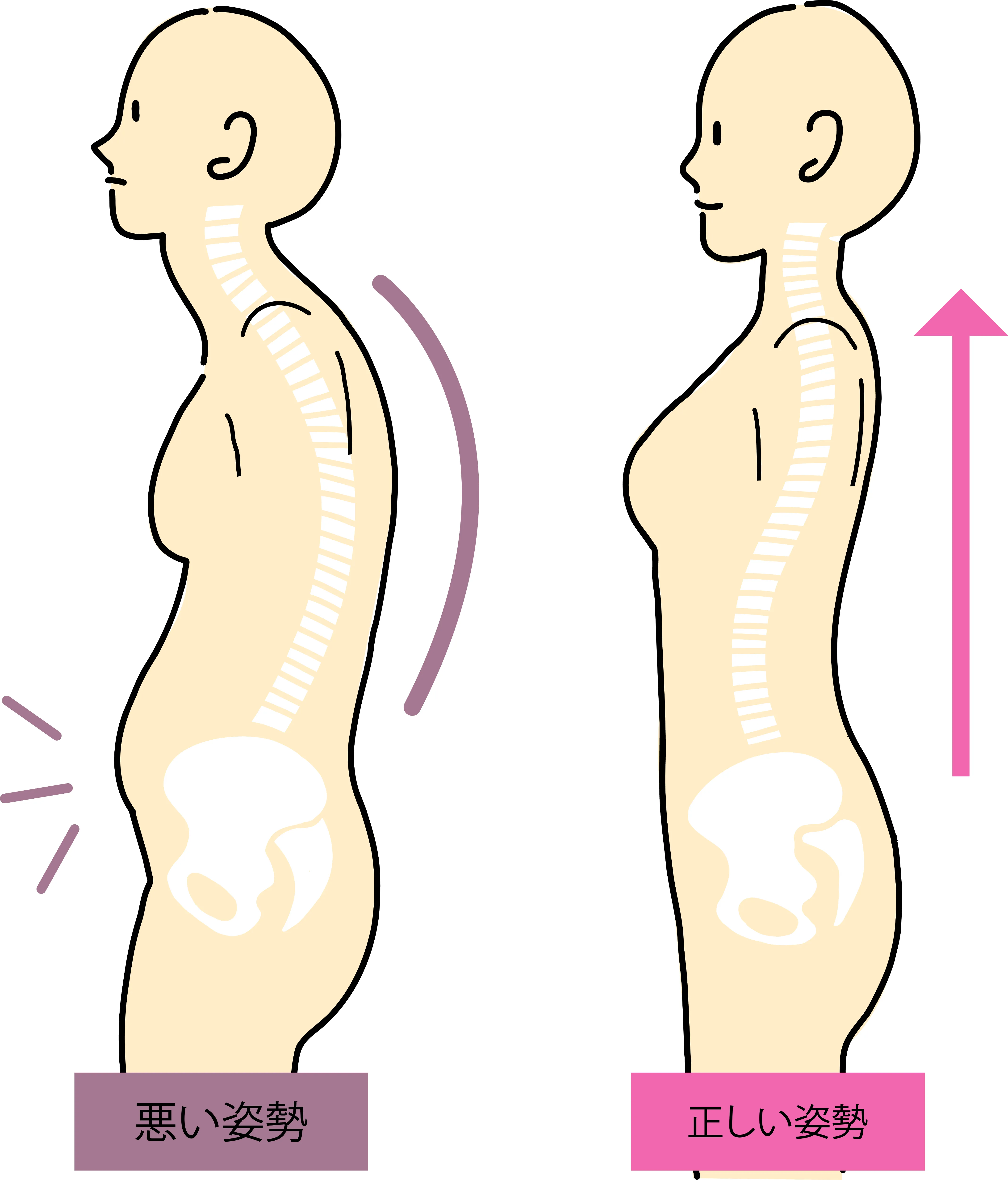 正しい姿勢と悪い姿勢で骨盤と背骨の位置が変わる様子のイラスト